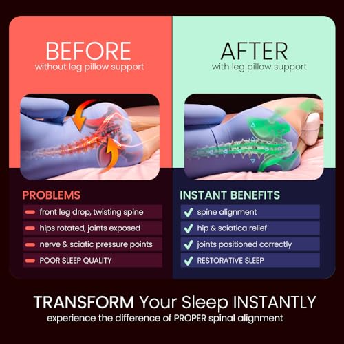 Contour Legacy Leg & Knee Foam Support Pillow - Soothing Relief for Sciatica, Back, HIPS, Knees, Joints - As Seen on TV